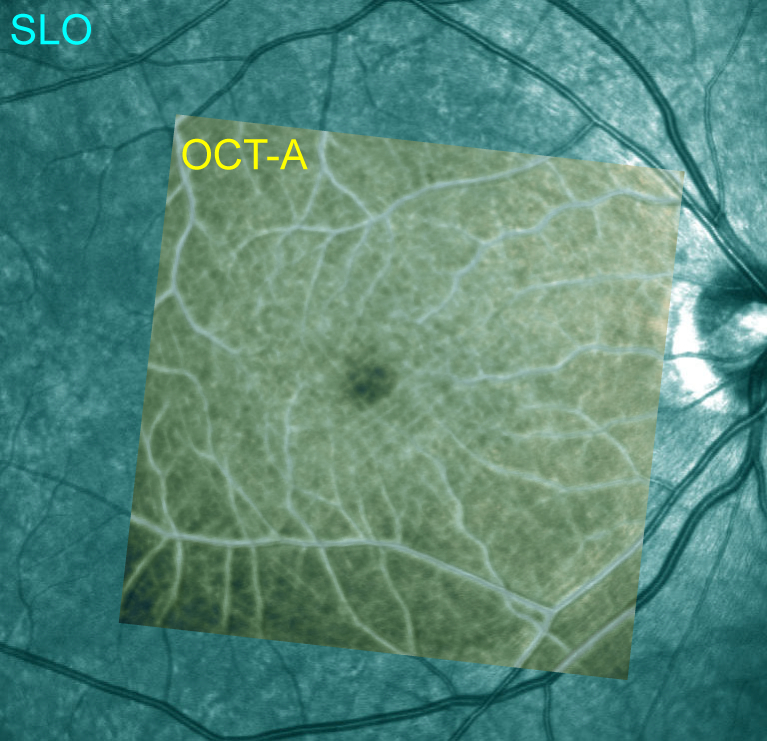 Fig. 7