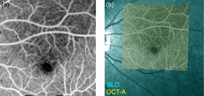 Fig. 12