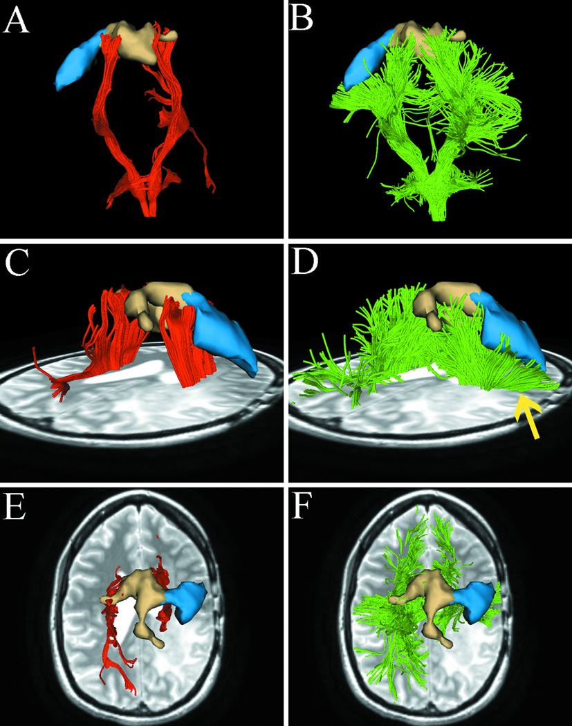 Fig. 4