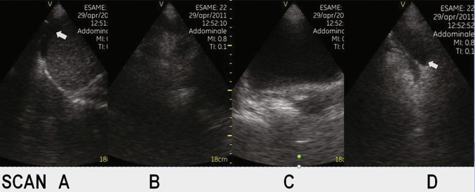 Fig. 2