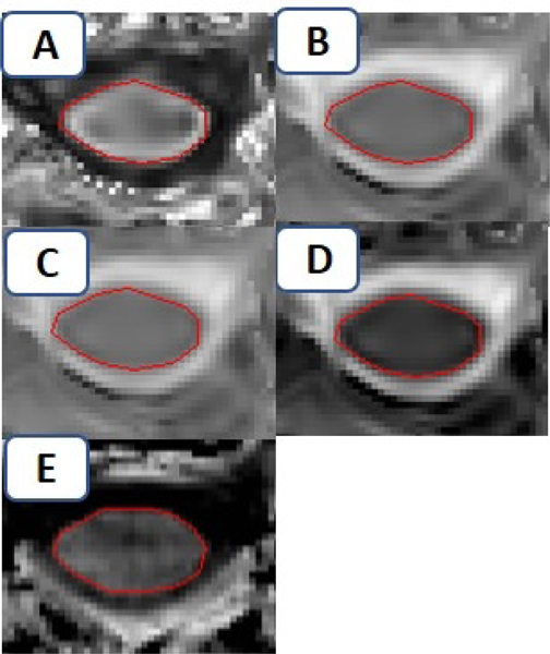 Figure e-1: