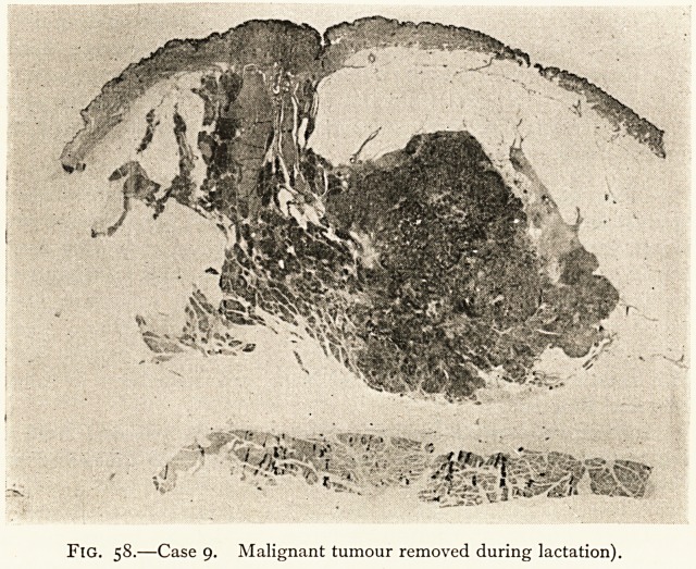 Fig. 58.—Case 9.