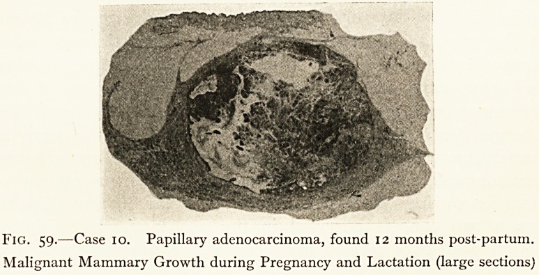 Fig. 59.—Case 10.