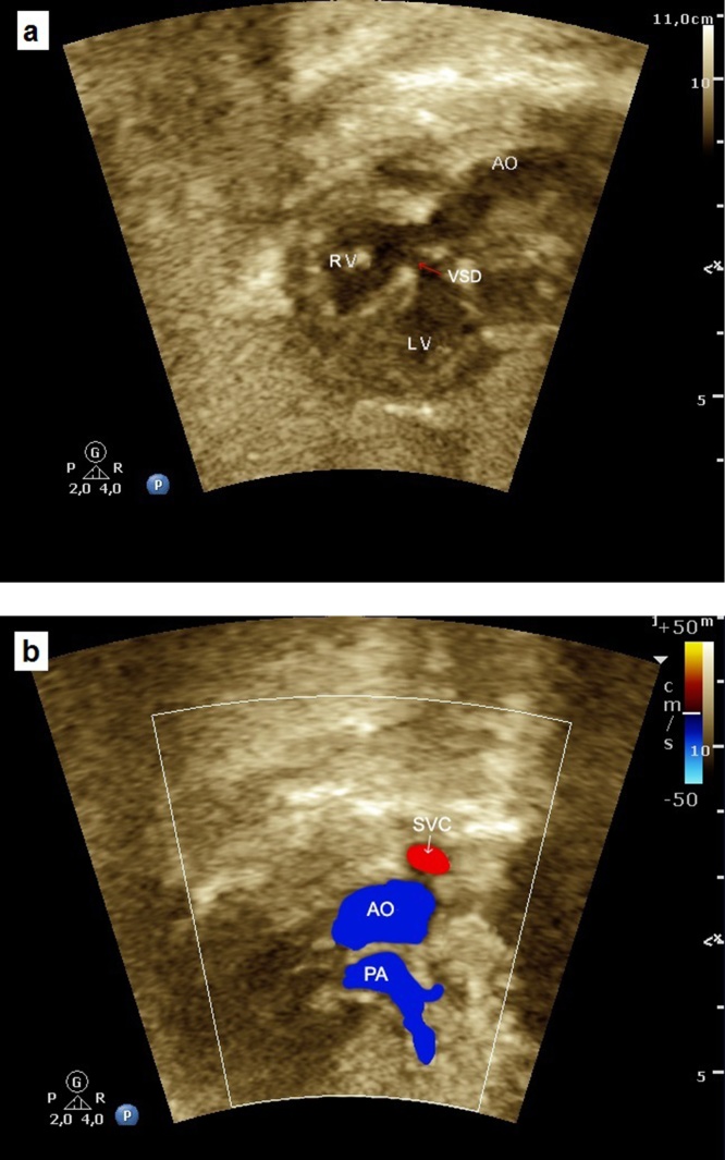 Fig. 18