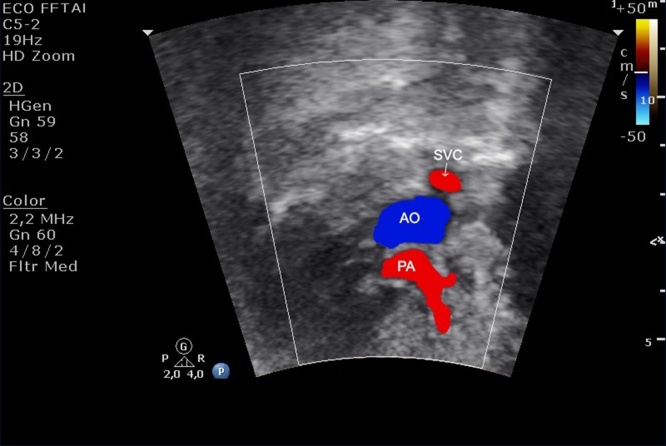 Fig. 14