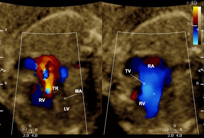 Fig. 17