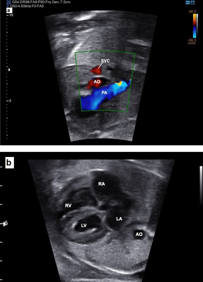 Fig. 16