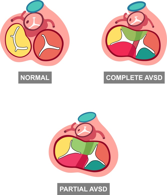 Fig. 11