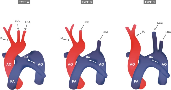 Fig. 21