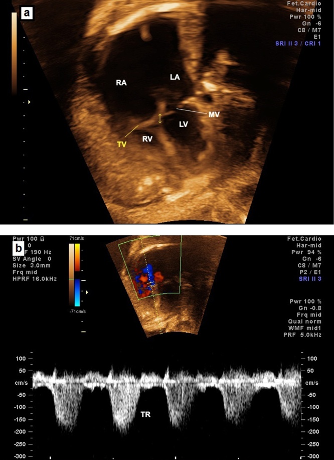 Fig. 15