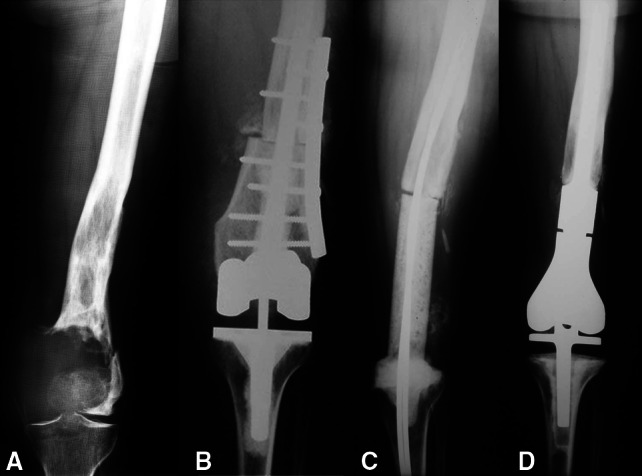 Fig. 2A–D