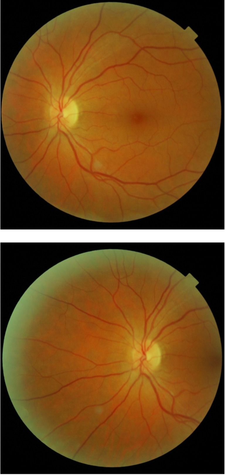 Fig. 2