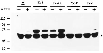 FIG. 11