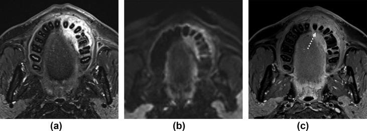 Figure 10