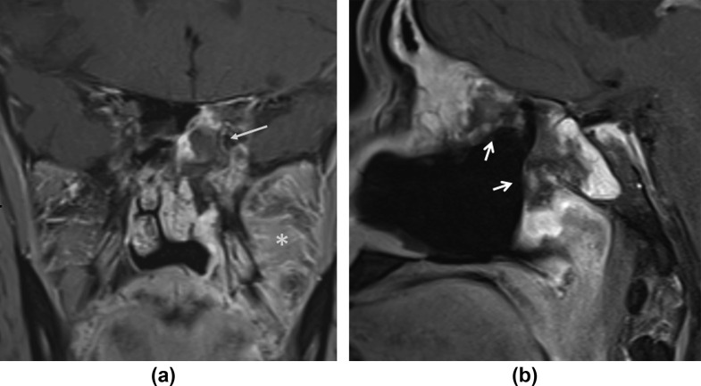 Figure 11