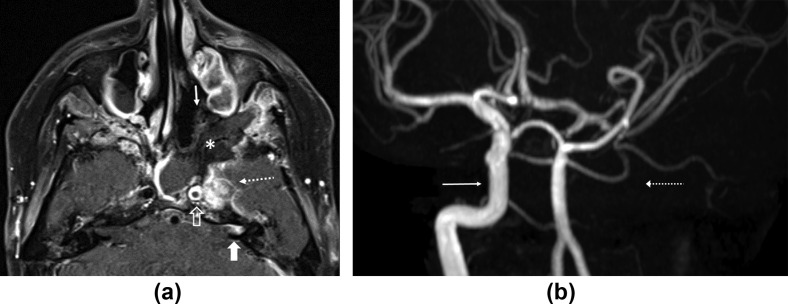 Figure 3