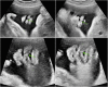 Fig. 3