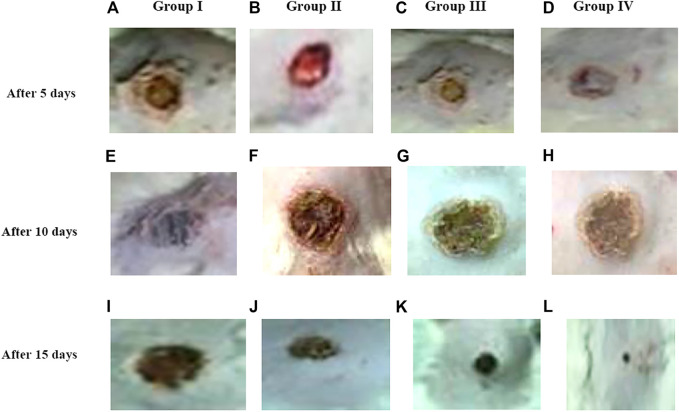 FIGURE 13