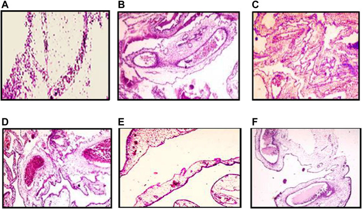 FIGURE 11