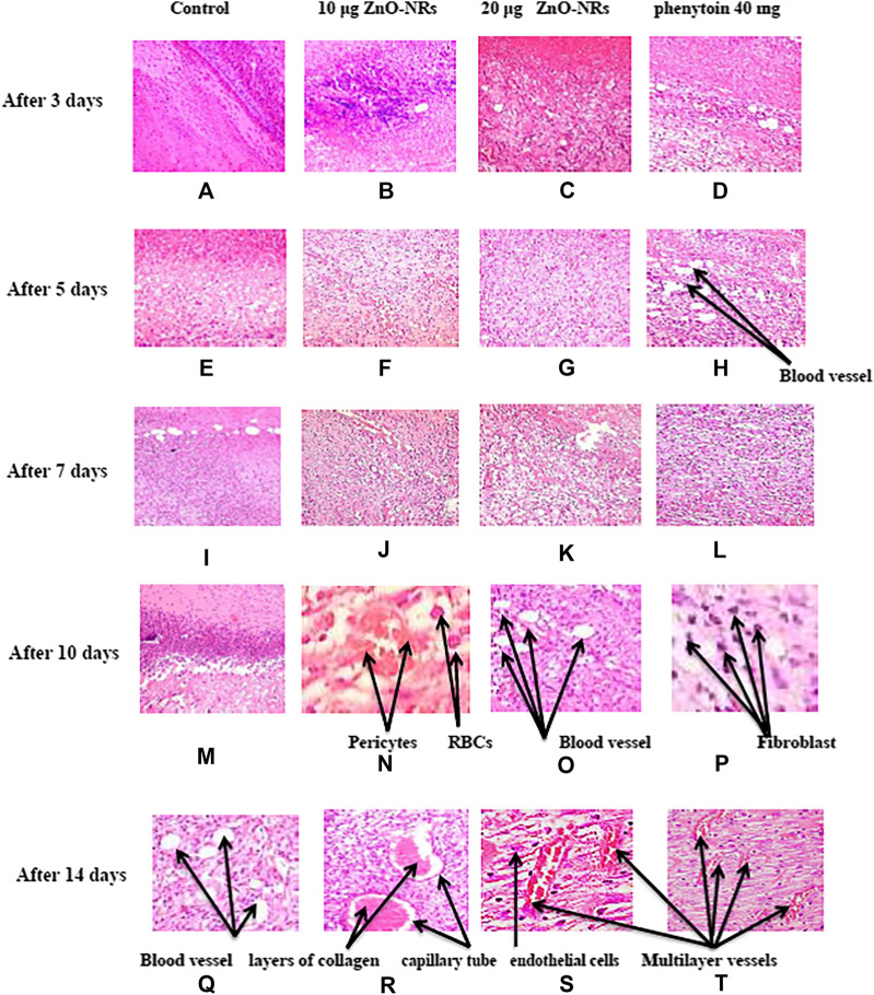 FIGURE 14