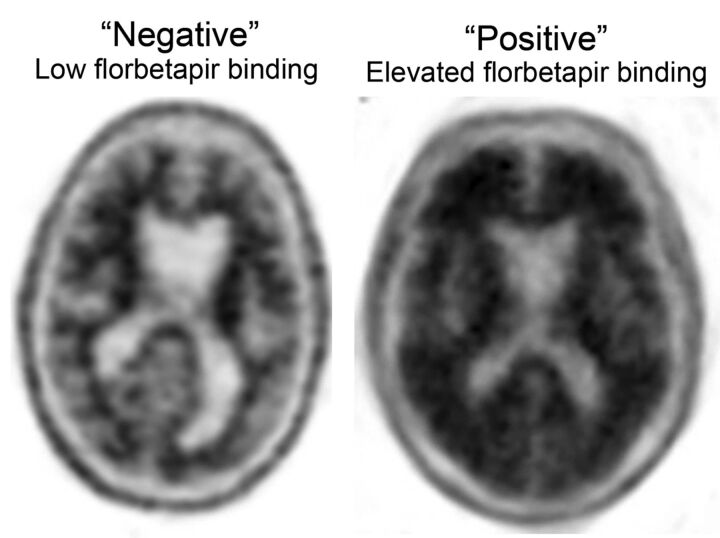 Fig 3.