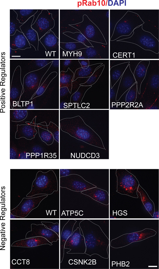 Figure 1—figure supplement 2.