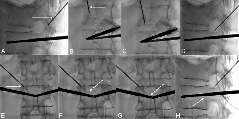 Fig 3.