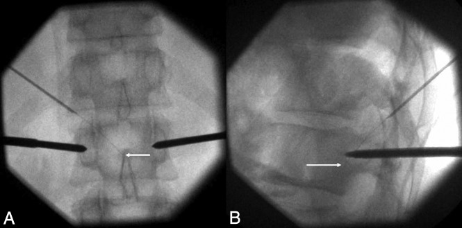 Fig 1.