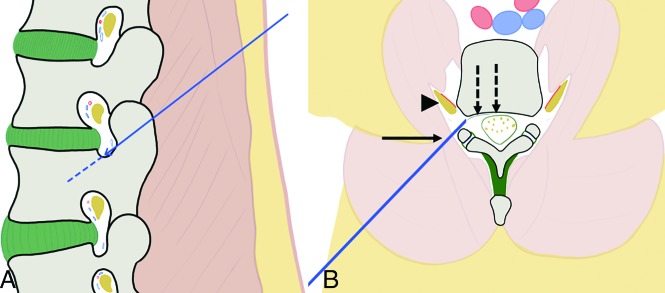 Fig 2.