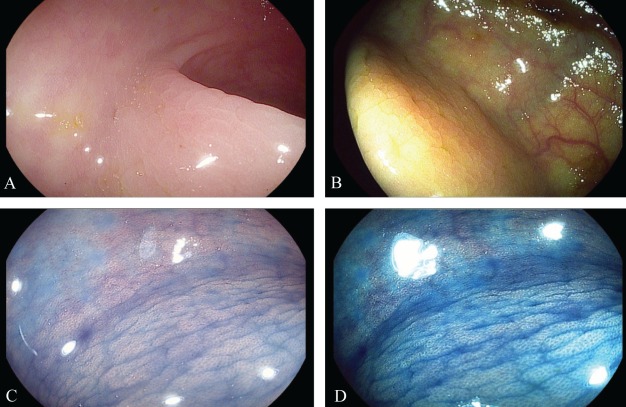 Figure 1)