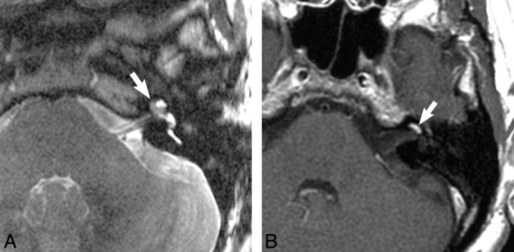 Fig 1.