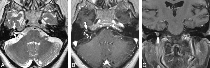 Fig 3.