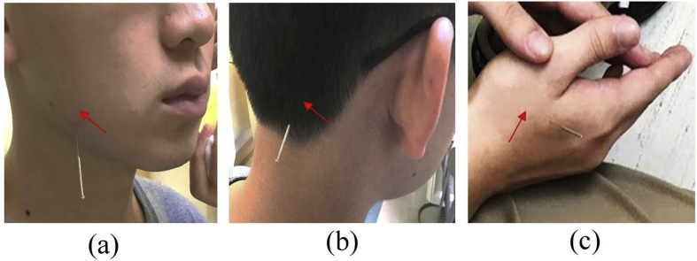 Figure 1