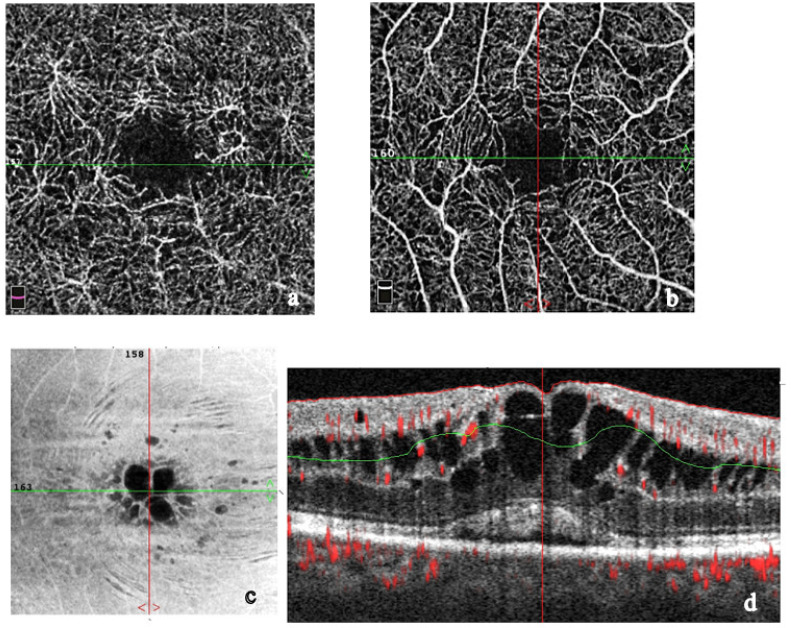 Figure 11