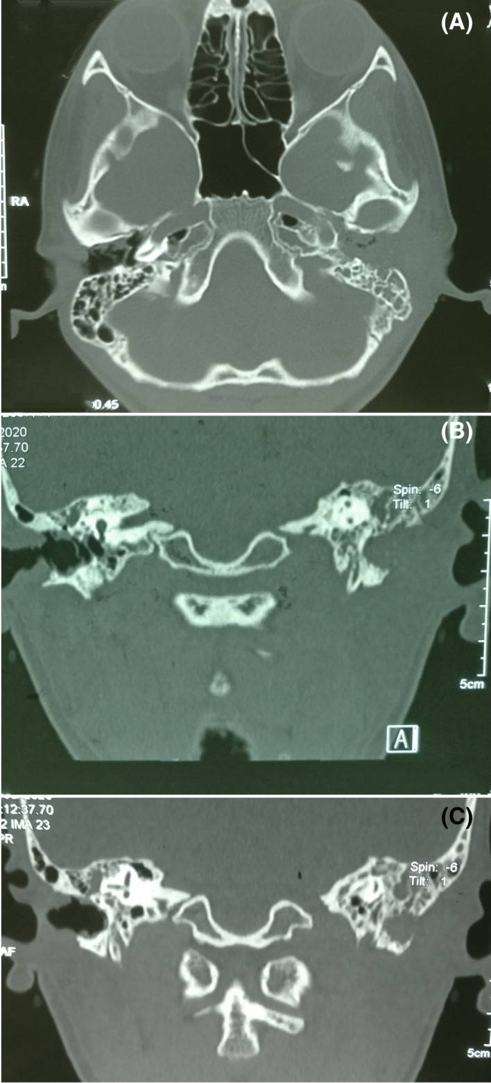 FIGURE 2