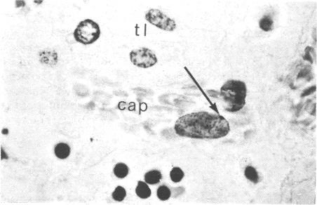 p15-a