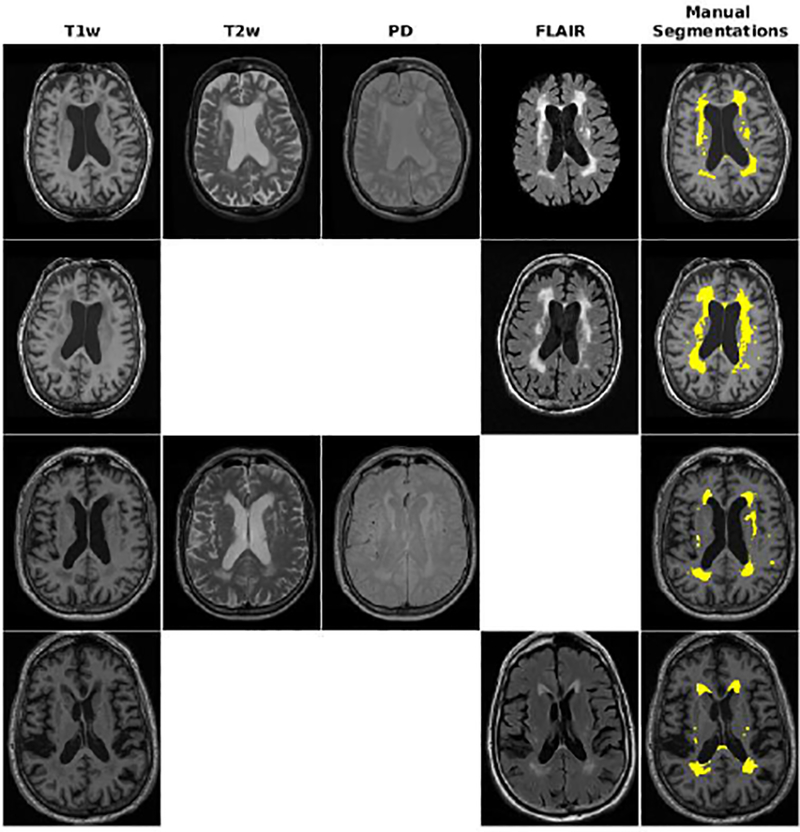 Fig. 1 -