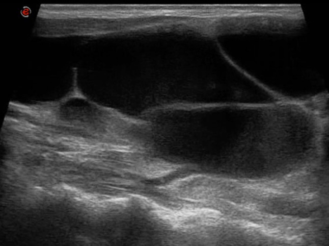 Fig. 10