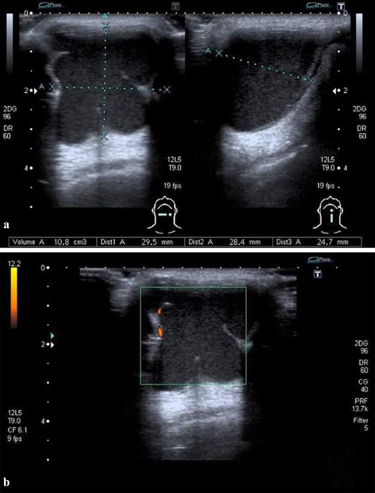 Fig. 2