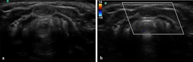 Fig. 8