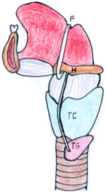 Fig. 1