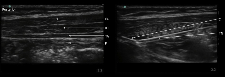 Figure 3