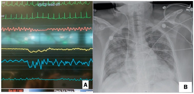 Figure 3.