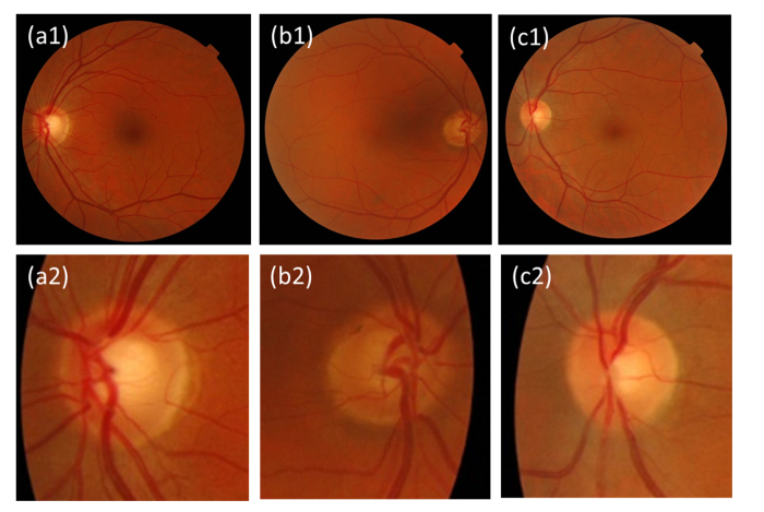 Fig. 2