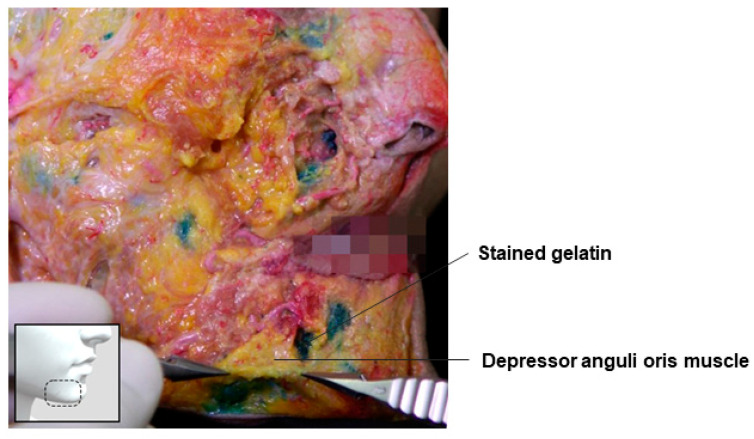 Figure 22