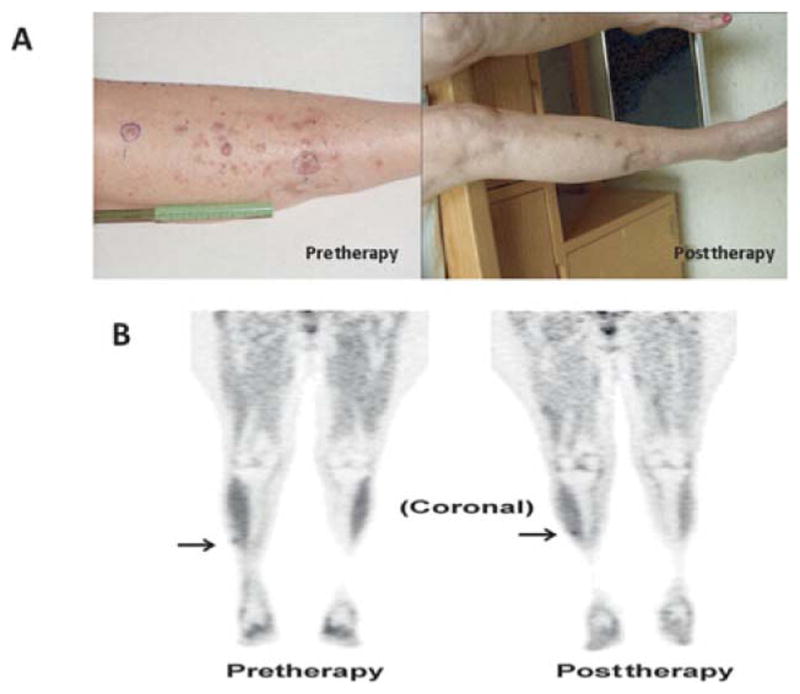 FIGURE 4