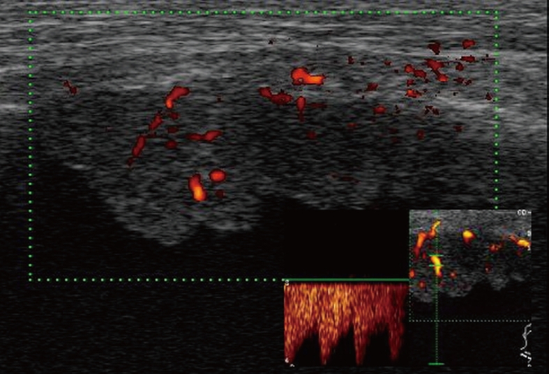 Figure 13