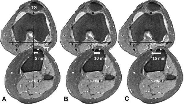 Fig. 1 A-C