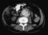 FIG. 1.