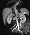 FIG. 2.